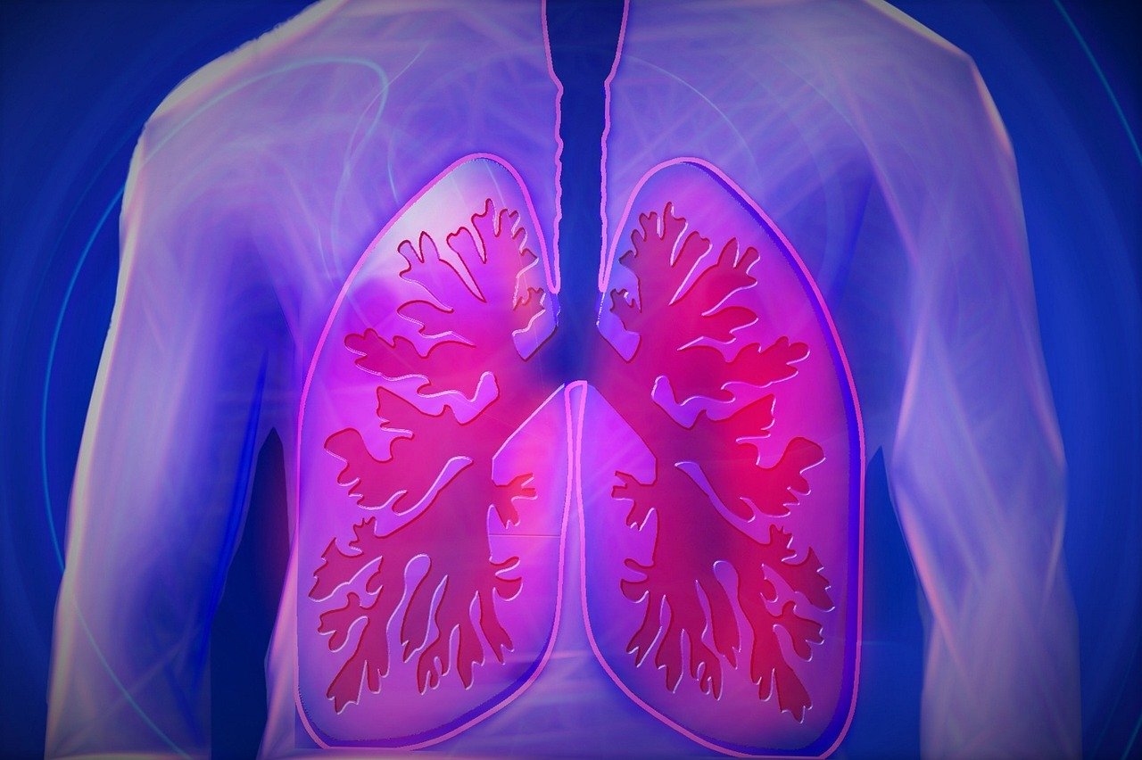 upper body x-ray of lungs